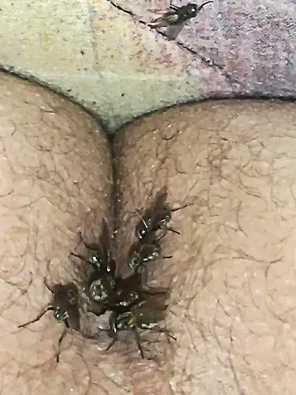 Flies on my anus in the village.  06. 2025