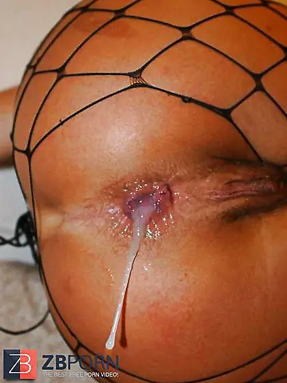 Analized Bums - Part