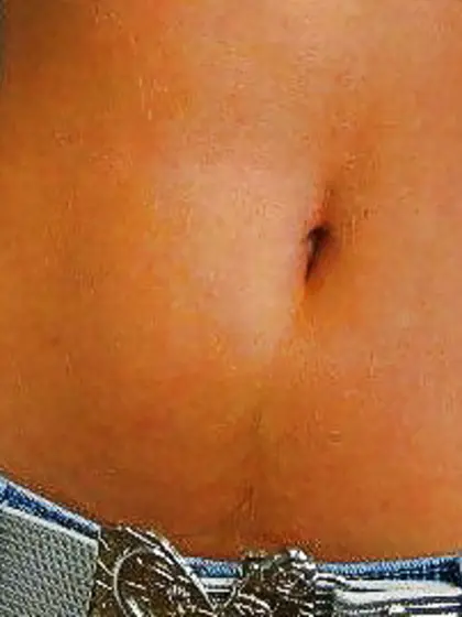 belly button