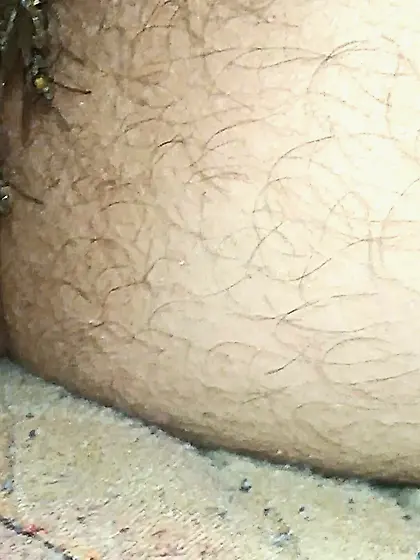 Flies on my anus in the village.  06. 2025