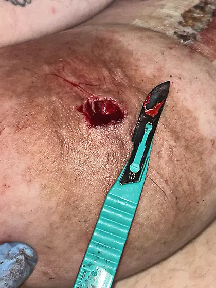 Contact if you are interested in the videos