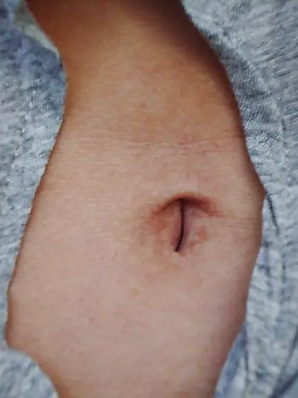 belly button