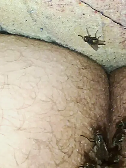 Flies on my anus in the village.  06. 2025