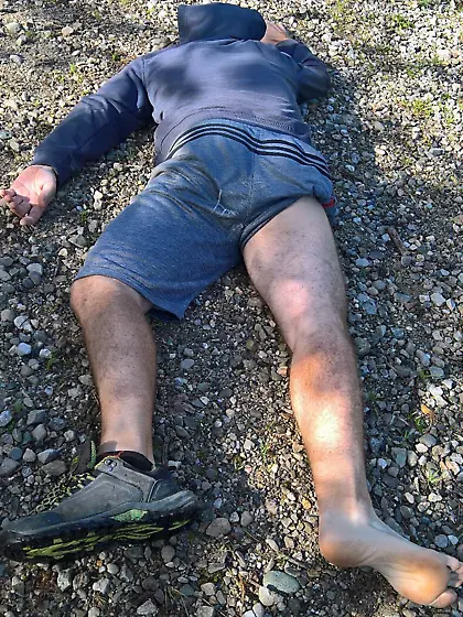 Andy sedated Gymnast 6