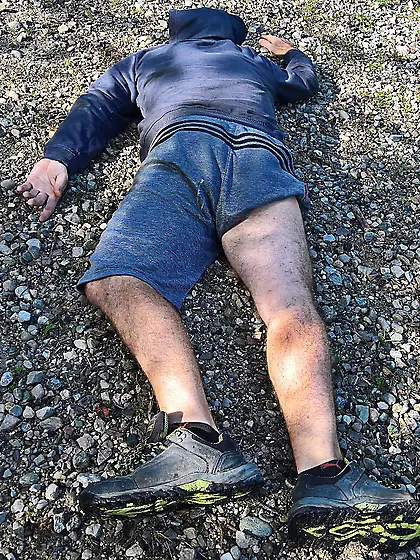 Andy sedated Gymnast 5