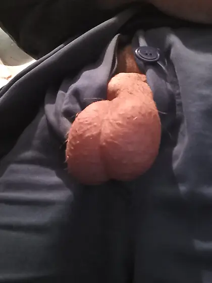 My friend's genitals