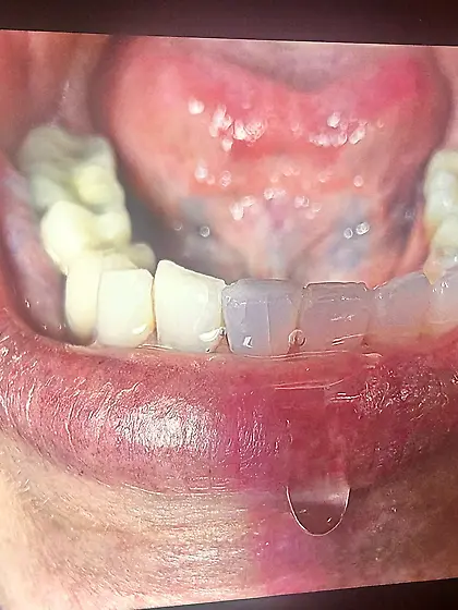 Add your sperm to Denise’s mouth