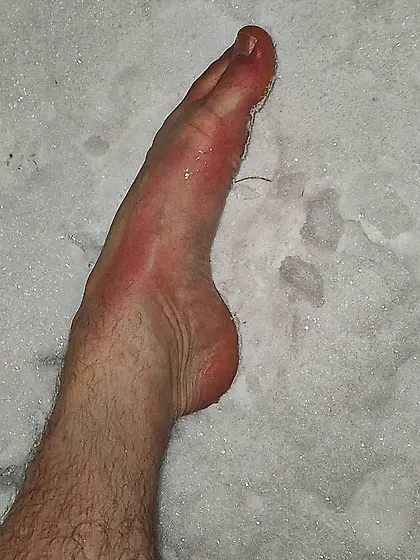 My feet on snow.  Temperature -20°C.