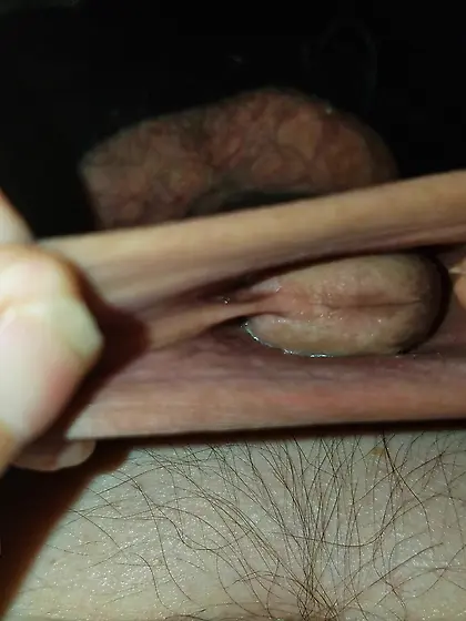 XXL foreskin to be filled with a cock or a big gla