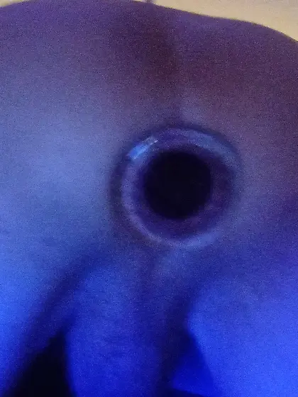 There is allot more, ...  dissobay me more plz