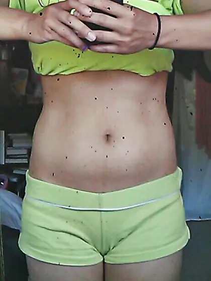 belly button