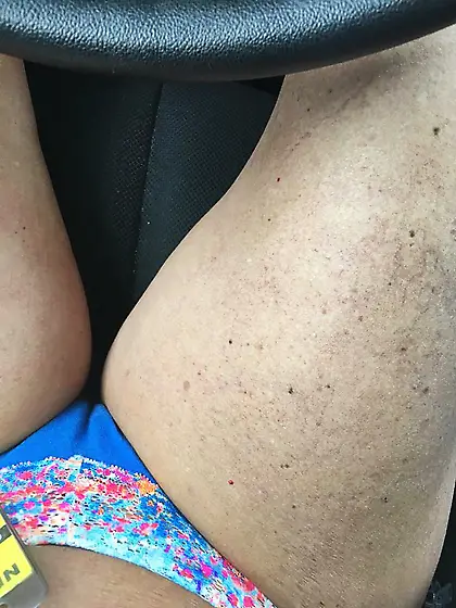 Hoes in different area codes