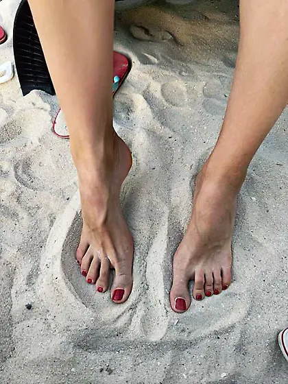 Huge feet