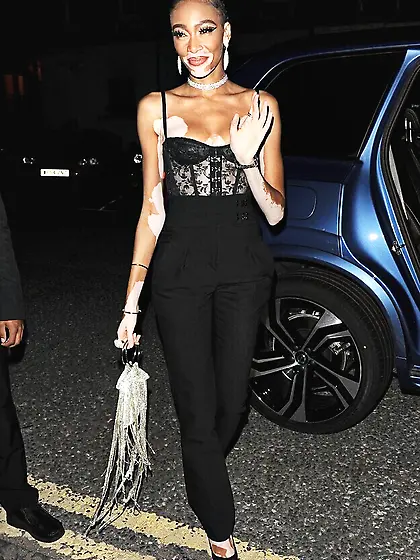 Winnie Harlow Cleavage