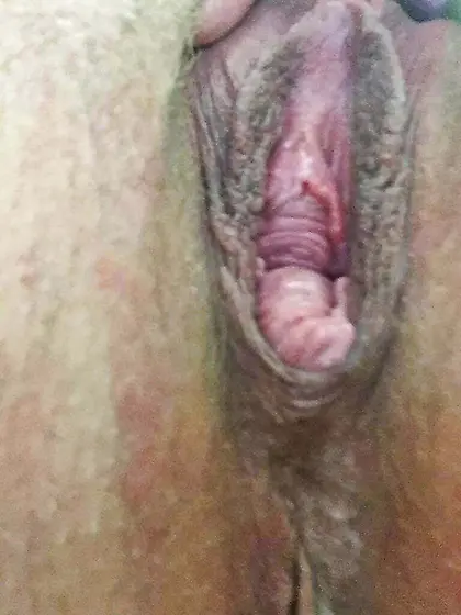 Tracy shared by loving husband