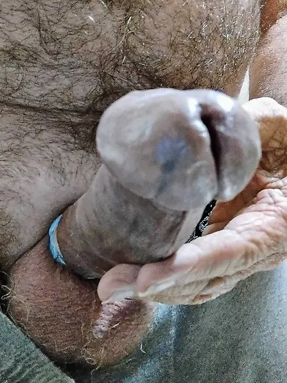 Penectomy Penis