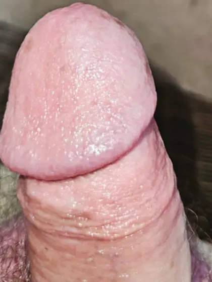 My cock head