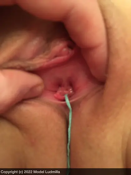 Gyno exam of a young german pussy with tampon