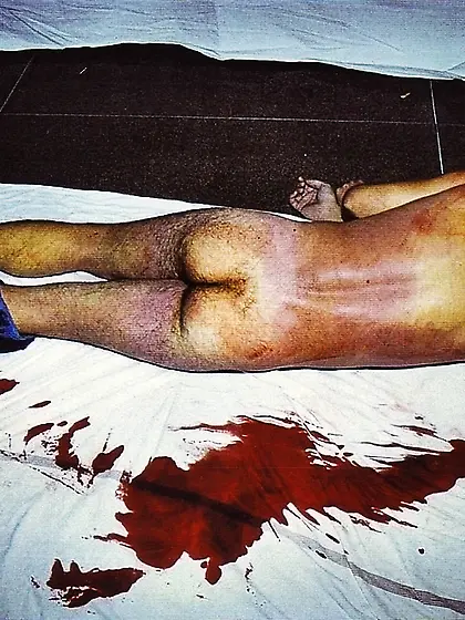 Morgue - The Rear View