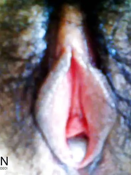 Chinese chick secretly drilled by gynecologist