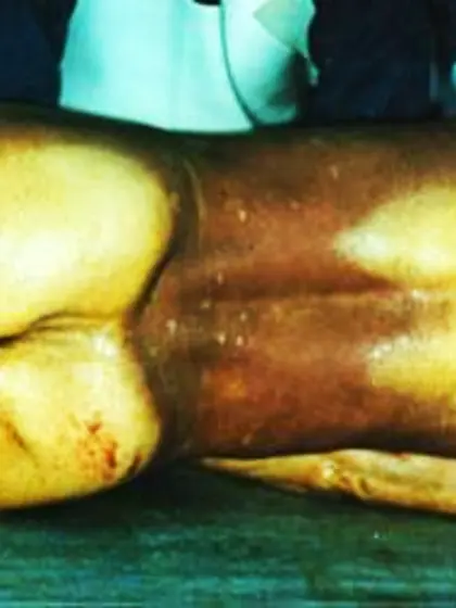 Morgue - The Rear View