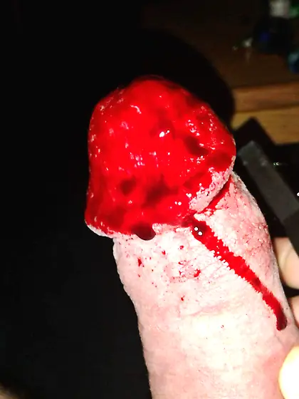 cockhead vs wire brush