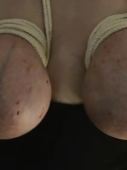 Propertys bound udders filled with 2x500 ml saline