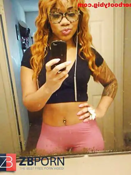 Chick Diagnosed With Ghetto Ass