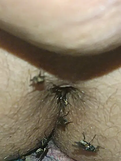 Flies on my anus in the village. 06. 2025