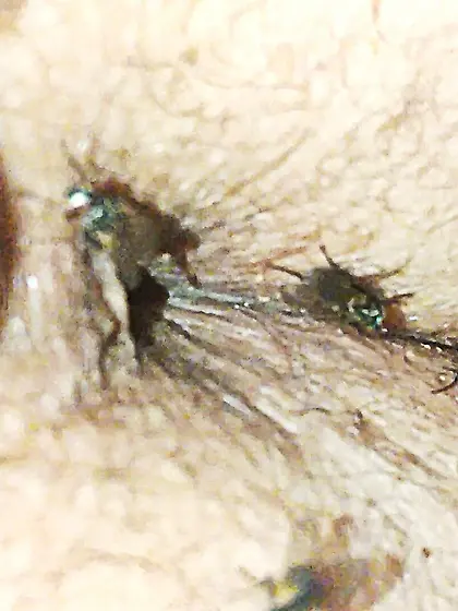 Flies on my anus in the village. 06. 2025