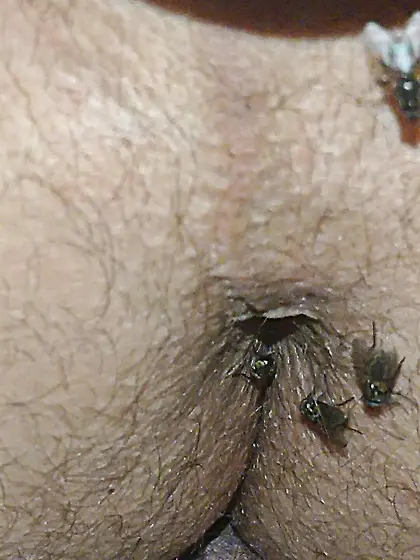 Flies on my anus in the village.  06. 2025