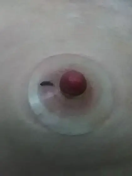 self nippel play