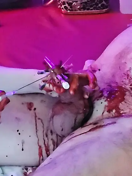Heavy and bloody needle play on my poor cock.