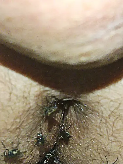 Flies on my anus in the village.  06. 2025