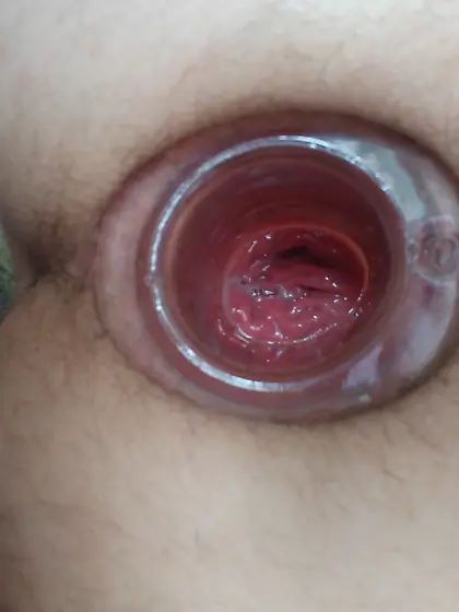 My anal hole