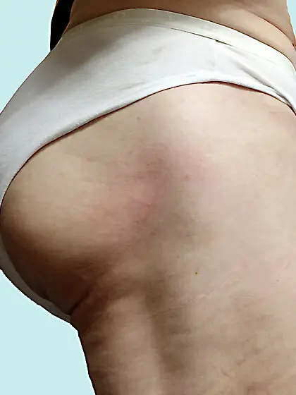 ass-09