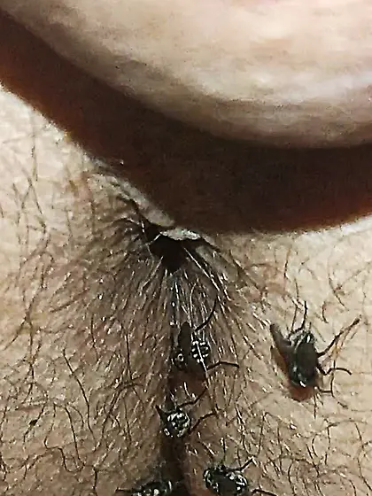 Flies on my anus in the village.  06. 2025