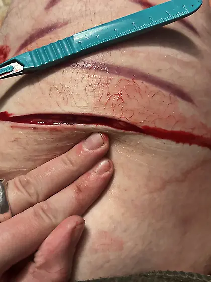 more knife play,  this time with a scalpel