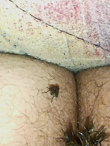 Flies on my anus in the village.  06. 2025